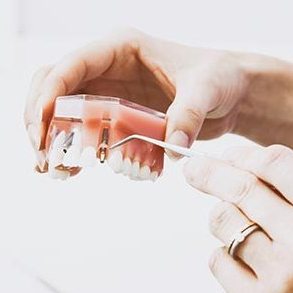 Implantes y prótesis