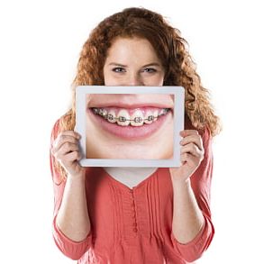 Ortodoncia y Estética